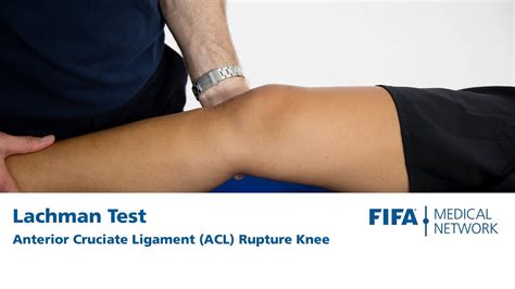 acl injury test